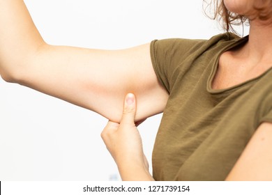 Woman Squeezing Cellulite On Her Upperarm