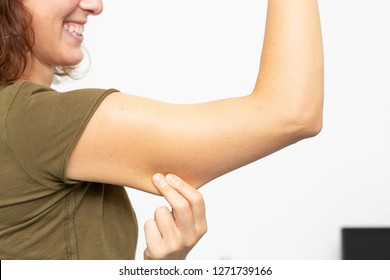 Woman Squeezing Cellulite On Her Upperarm