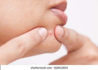 Woman, Squeezing Pimples, Facial.