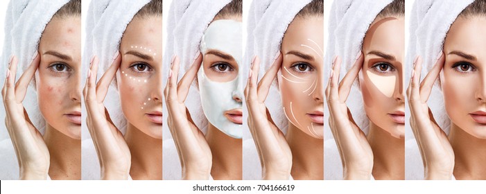 Woman Step By Step Improves Her Skin Condition.