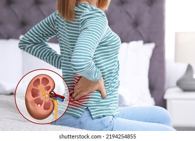 Woman suffering from pain because of kidney stones disease at home - Shutterstock ID 2194254855