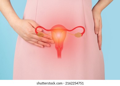 Woman suffering from pelvic pain with uterus and ovaries anatomy. Cause of pain inclued dysmenorrhea, edometriosis, PCOS, PMS, STDs, gynecologic cancer. Reproductive system and woman health problems.