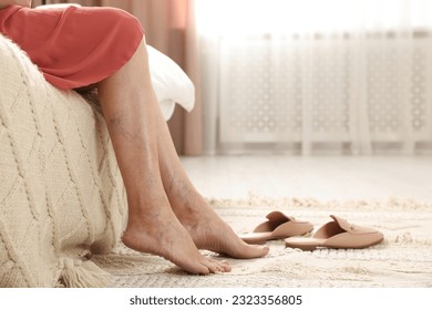 Woman suffering from varicose veins at home, closeup. Space for text