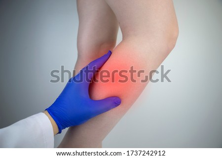 A woman suffers from pain in the calves. Stretching the calf muscle, varicose veins, leg cramps, or myositis. Orthopedic doctor examines patient