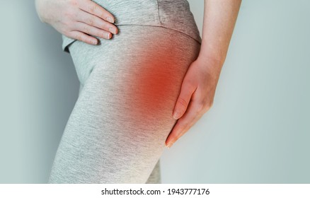 A Woman Suffers From Piriformis Syndrome, Pain In Buttocks Muscle Caused By Sciatic Nerve Irritation