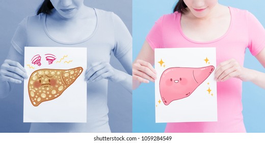 Woman Take Liver Billboard With Health Concept On The Blue Background