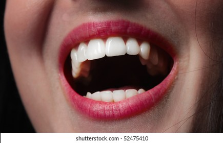 Woman Teeth Close Up Smiling Mouth