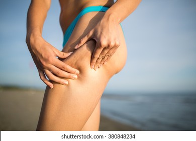 Woman Is Testing The Skin For Stretch Marks And Cellulite On The Beach.Woman Holding/showing Cellulite Area.Self Consciousness,self Confidence And Body Insecurity.Summer Beach Body.Cellulite Removal