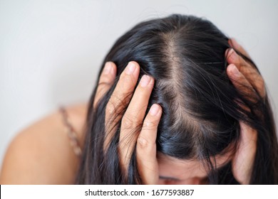 Woman with thin hair problem.