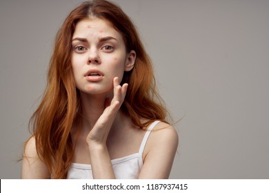 Ugly Teenager Images Stock Photos Vectors Shutterstock