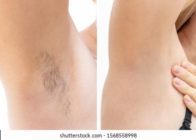 Underarm Wax Images Stock Photos Vectors Shutterstock