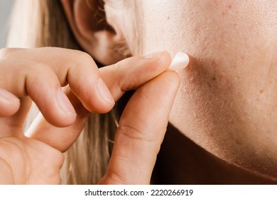 Woman Using Acne Patches For Treatment Of Pimple And Rosacea Close-up. Facial Rejuvenation Cleansing Cosmetology. Girl With Acne Stick Round Acne Patch On Her Cheek