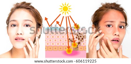 woman using sunscreen and woman getting sunburned