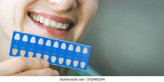 Woman Using Teeth Whitening Shade Guide. Tooth Bleaching. Banner Copy Space