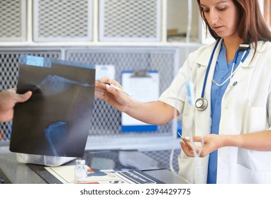 Woman, veterinarian and doctor with xray at animal shelter for examination, tests or diagnosis on injury at vet. Female person, nurse or medical pet professional receiving CT scan or MRI at clinic
