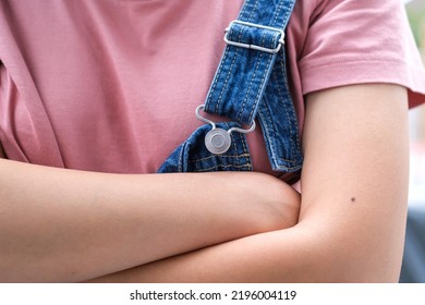 Woman Wearing Bib Overalls With Mole On Skin