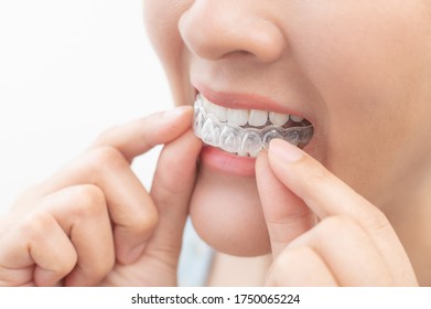 Woman wearing orthodontic silicone trainer. Mobile orthodontic appliance for dental correction. tooth whitening systems. - Shutterstock ID 1750065224