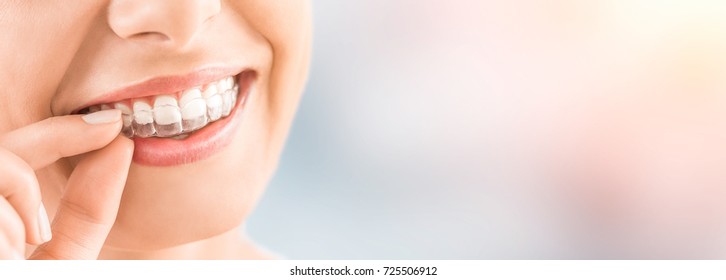 Woman wearing orthodontic silicone trainer. Invisible braces aligner. Mobile orthodontic appliance for dental correction.