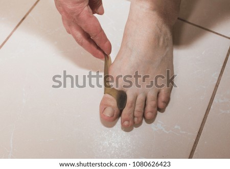 Woman is wearing the toe correction device. Healthy treatment photo.