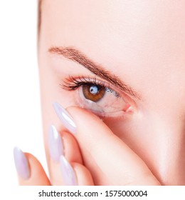 Woman Wears Contact Lenses On Irritated Eyes With Redness. Close-up Shot.