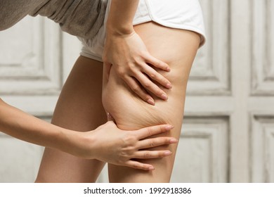 A woman who emphasizes thigh cellulite. - Shutterstock ID 1992918386