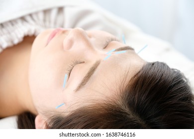 Up of a woman who is struck with acupuncture in the face in acupuncture clinic