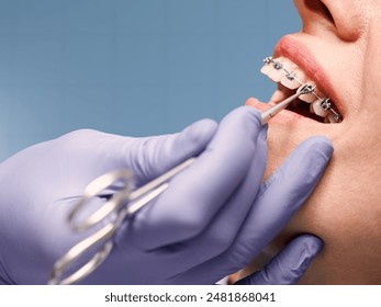 Woman with wired metal braces on teeth receiving orthodontic treatment.Hands of doctor wearing sterile gloves isolated on a Blue background. - Powered by Shutterstock