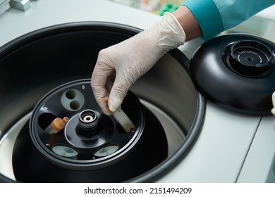 Woman Working In Labratory With Blood Tests