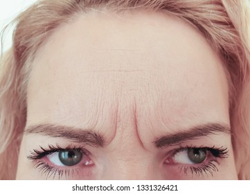 Woman Wrinkles Forehead