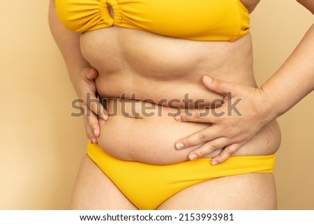 Woman in yellow swimsuit draw in thick belly with sagging folds using hands closeup, beige background. Slimming, fighting overweight, obesity and cellulite. Plus size people and body positive concept.