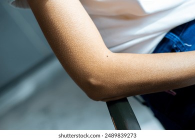 The woman's arms have hair that stands up from being so chilly - Powered by Shutterstock