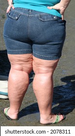 Chubby Legs Pics