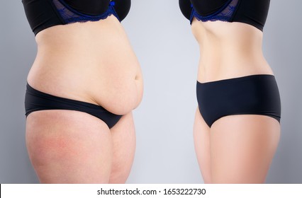 Woman's belly before and after weight loss on gray background, plastic surgery concept