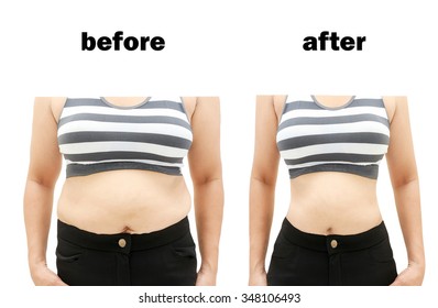 Woman's Body Before And After A Diet