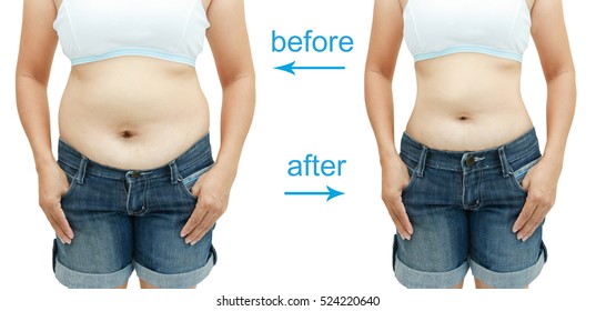 Woman's Body Before And After A Diet