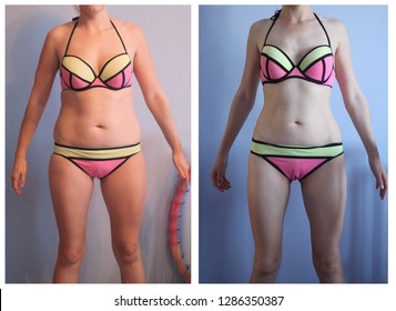 Woman's Body Before And After Weight Loss