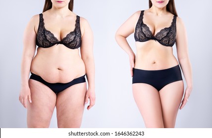 Woman's body before and after weight loss on gray background, plastic surgery concept