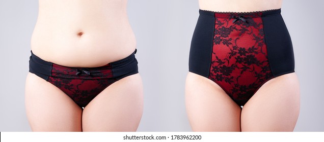 Woman's body before and after weight loss, flabby belly after pregnancy, fat woman in corrective panties on grey background, plastic surgery concept