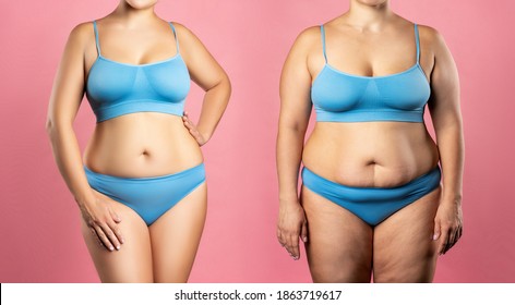 Woman's body before and after weight loss on pink background, plastic surgery concept