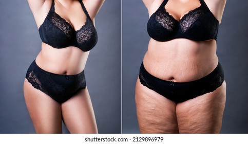 Woman's body before and after weight loss on gray background, plastic surgery concept