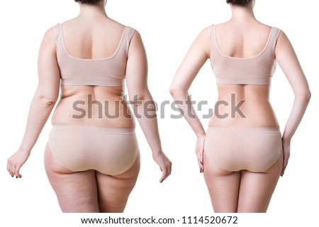 Woman's body before and after weight loss isolated on white background, plastic surgery concept