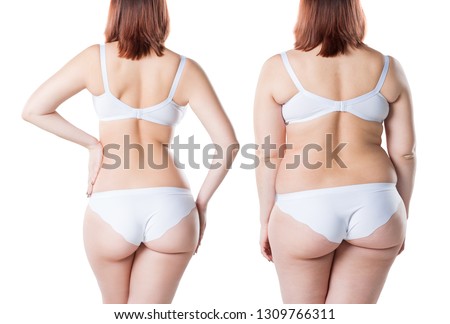 Woman's body before and after weight loss isolated on white background, plastic surgery concept