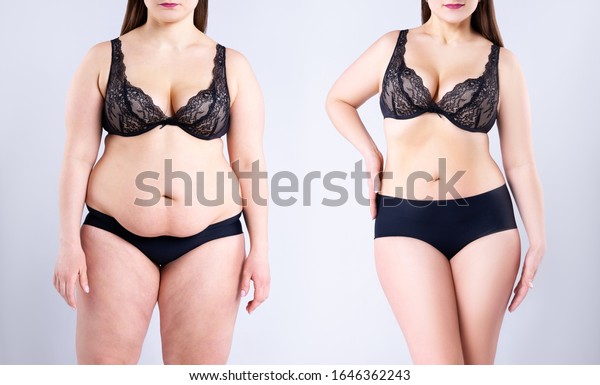 Woman\'s body before and after weight loss\
on gray background, plastic surgery\
concept