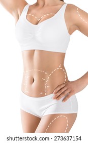 Woman's body marked out for cosmetic surgery. Isolated on white.
