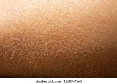 Woman's dry skin leg  Close up & Macro shot  Asian skin tone  Abstract background