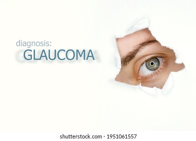 Woman`s eye looking trough teared hole in paper, word Glaucoma on left. Eye disease concept template. Isolated white background.