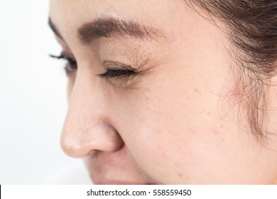 Woman's Eye Wrinkles On White Background