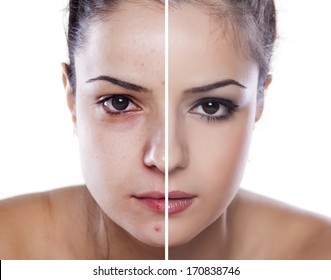 Woman's Face Before And After Makeup And Digital Editing