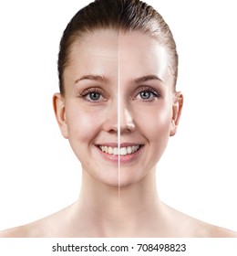 Woman's face before and after rejuvenation.