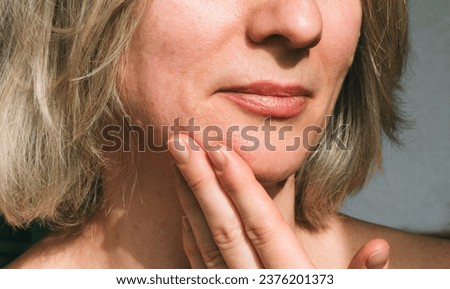 Woman's face with macro photo,  of large pores on combination skin. Care and cosmetics